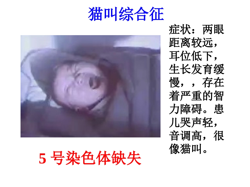 一染色体结构变异_第3页