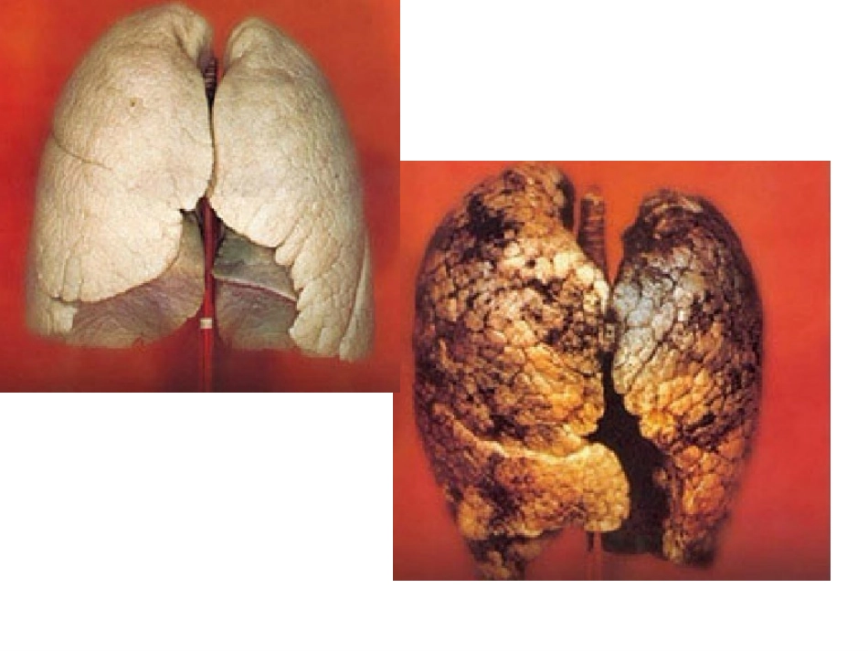 6呼吸与交换_第1页