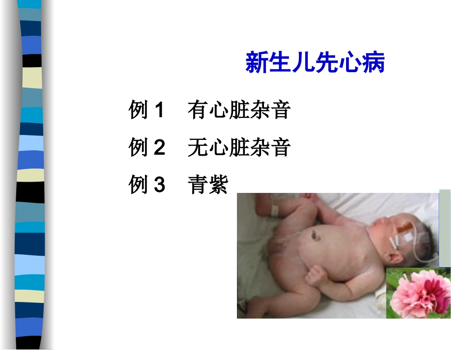 新生儿先天性心脏病病例讨论_第2页