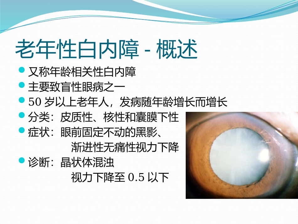 白内障的诊断与治疗_第3页