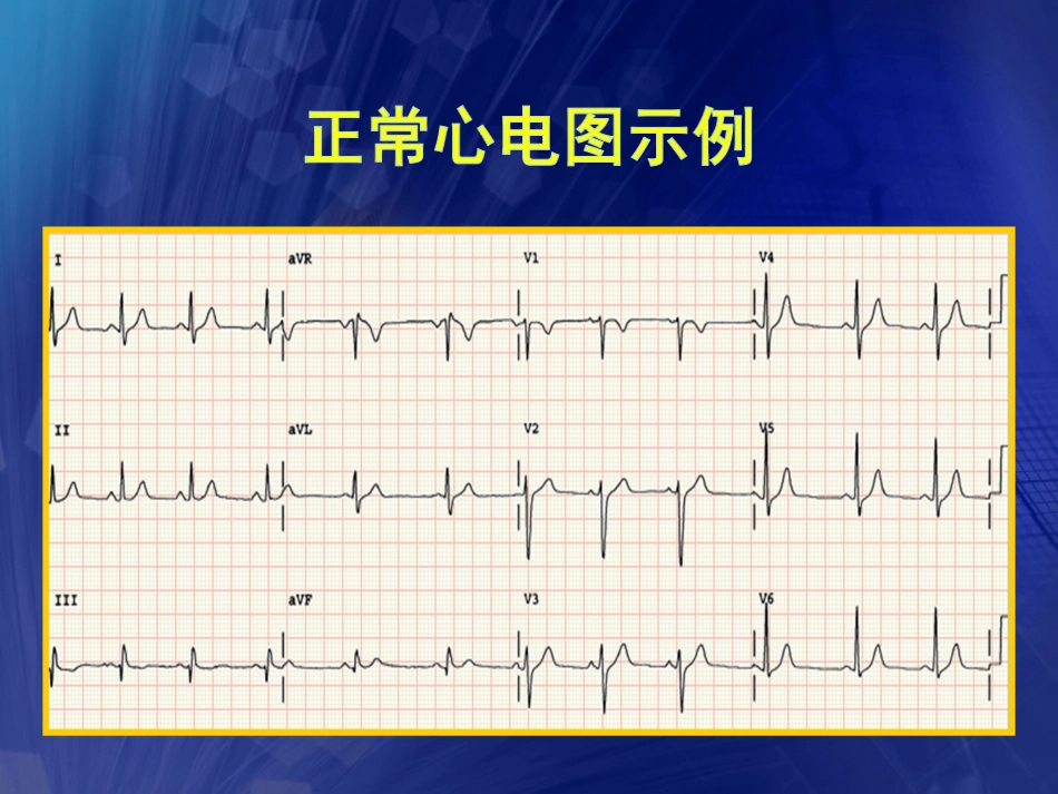 心电图基础知识-含常见异常心电图_第2页