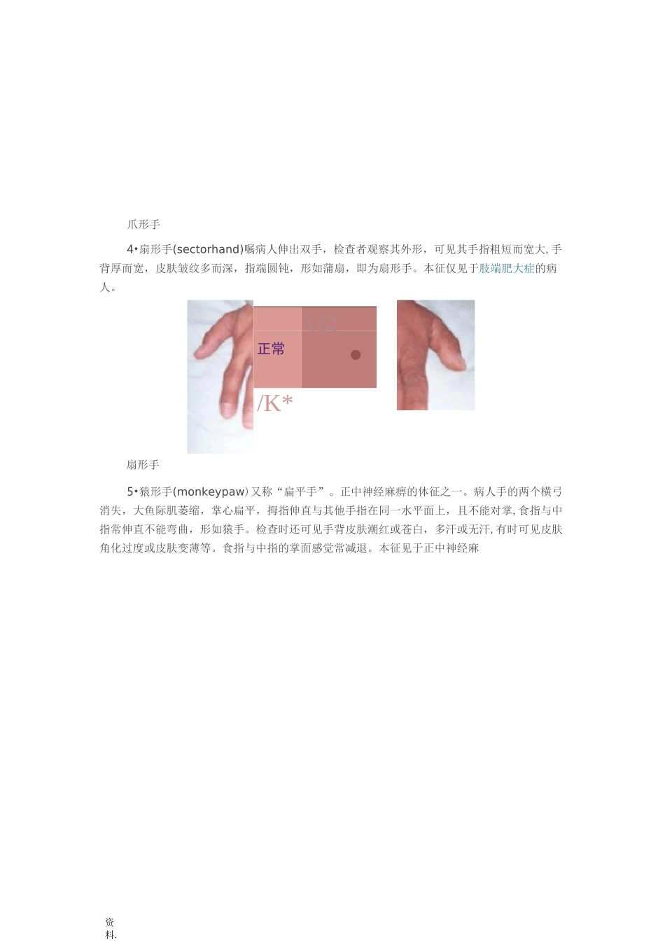 体格检查——四肢与关节检查_第3页