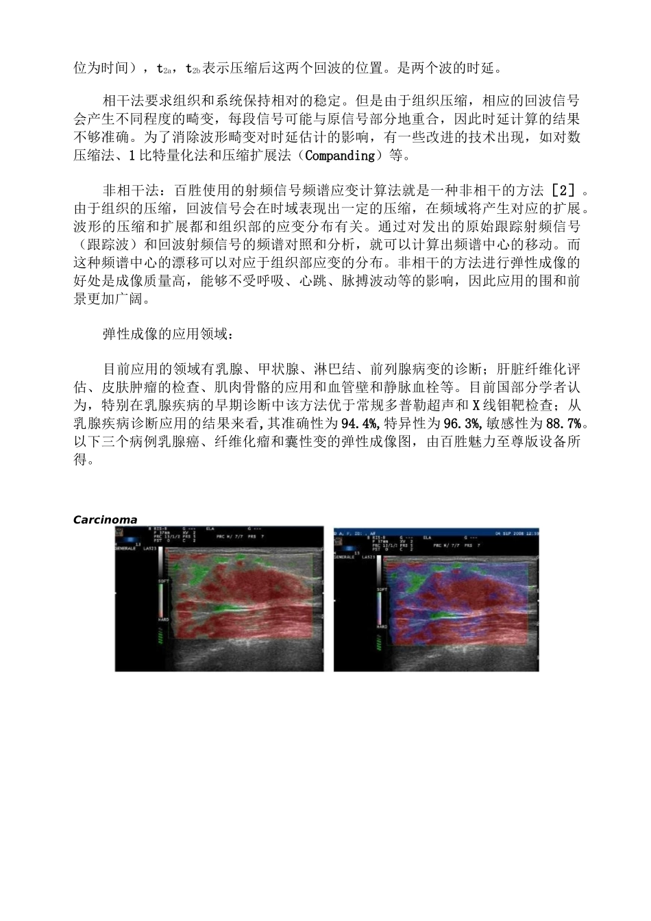 超声弹性成像_第2页
