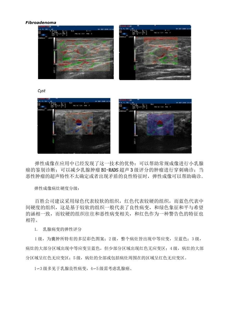超声弹性成像_第3页