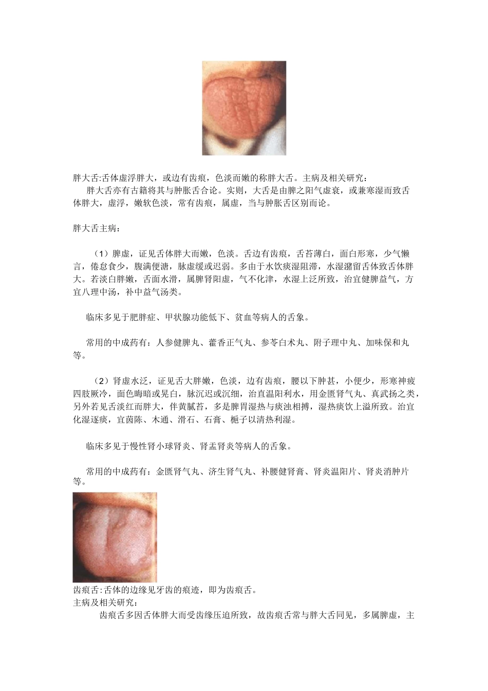 中医舌诊辨证_第3页