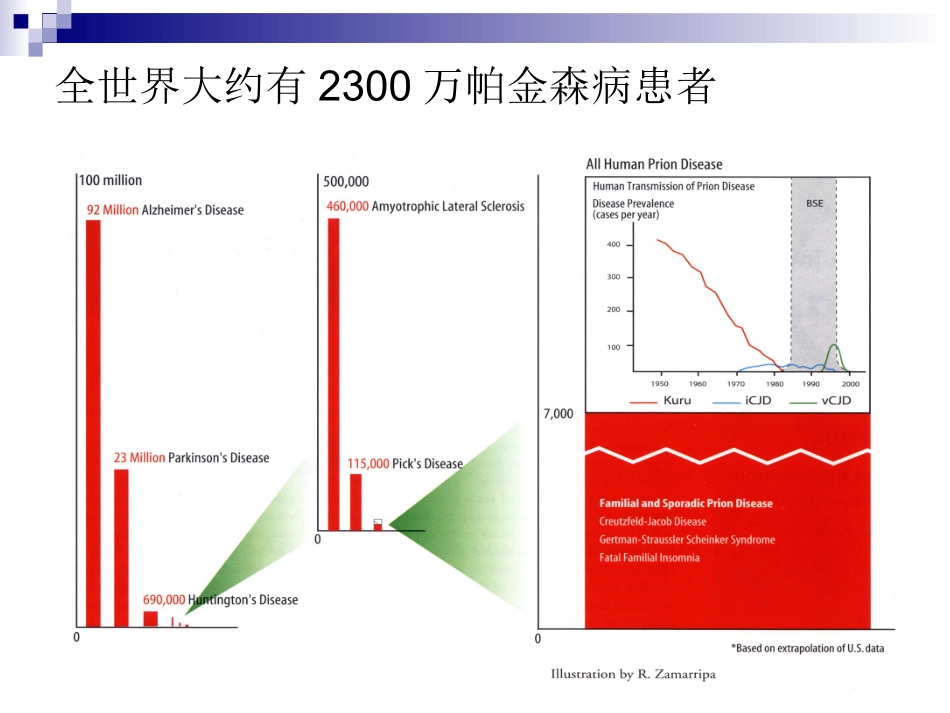 帕金森病(进修2009901)_第3页