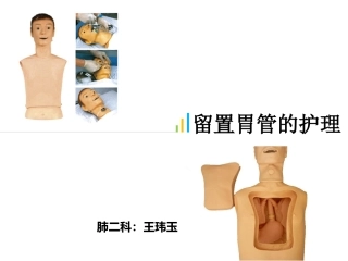 留置胃管的护理