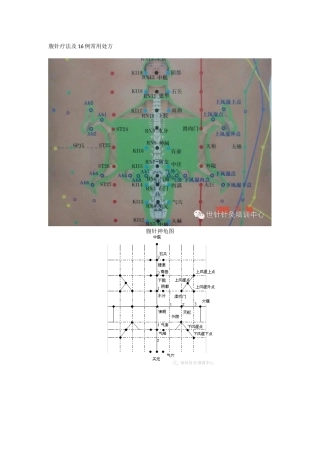 腹针疗法及16例常用处方