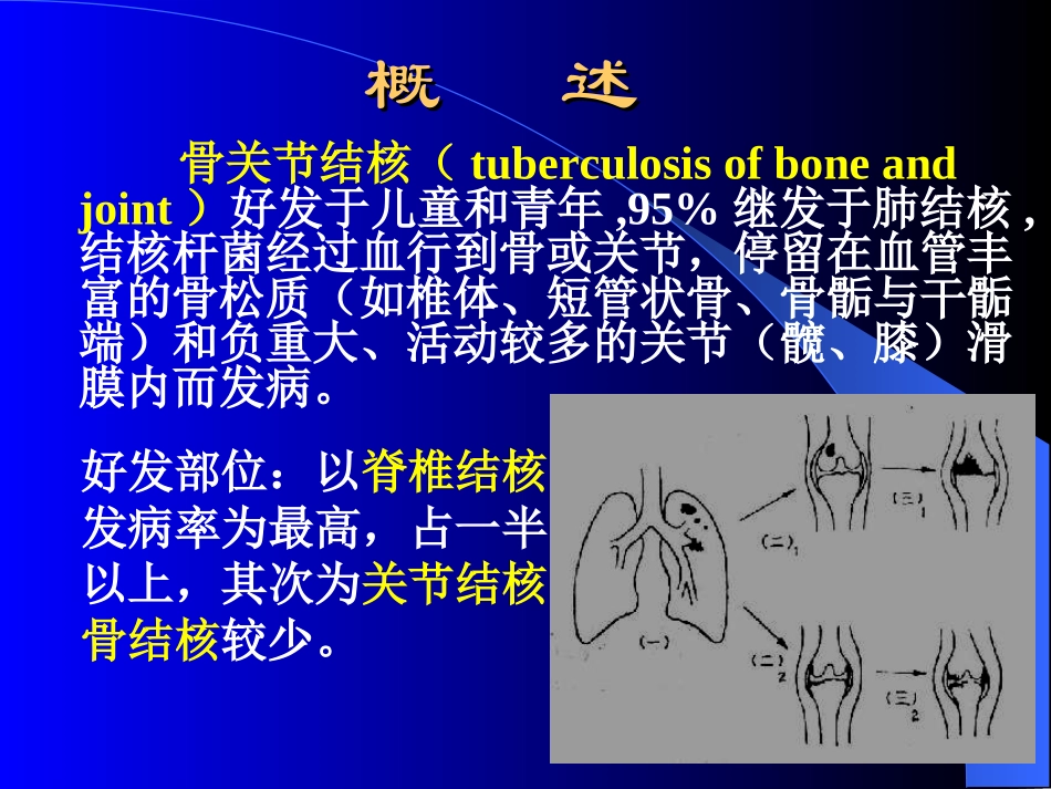 脊柱结核影像学表现_第3页