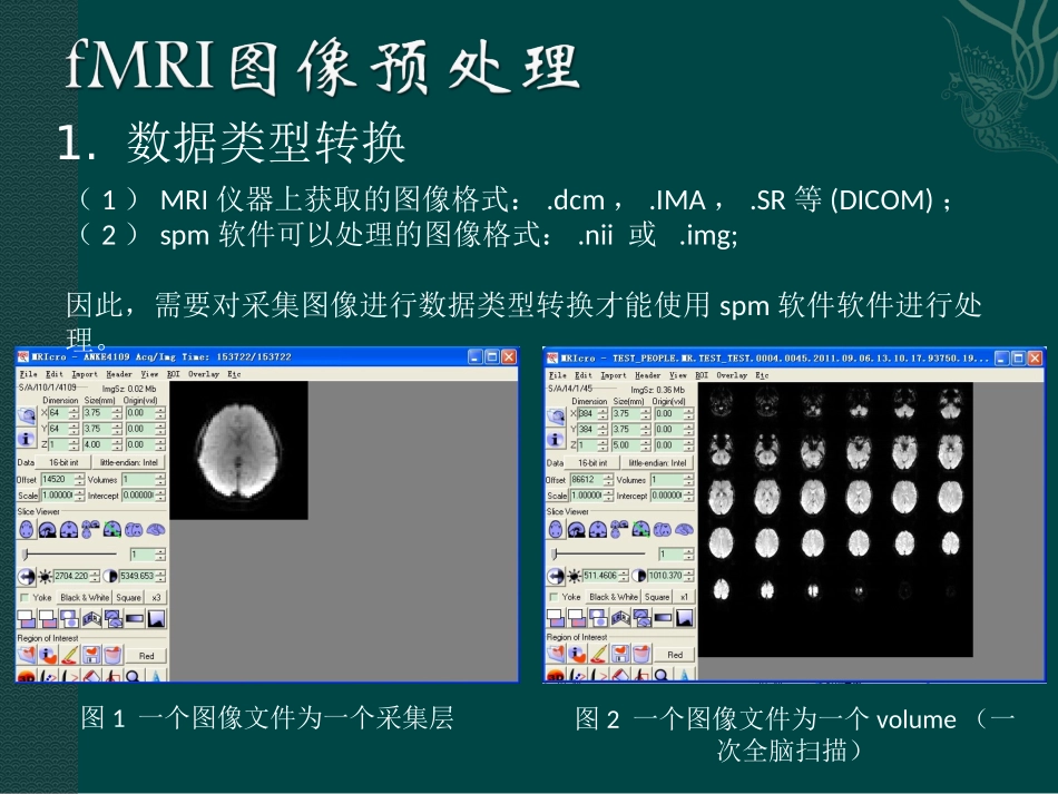 fMRI图像处理_第3页