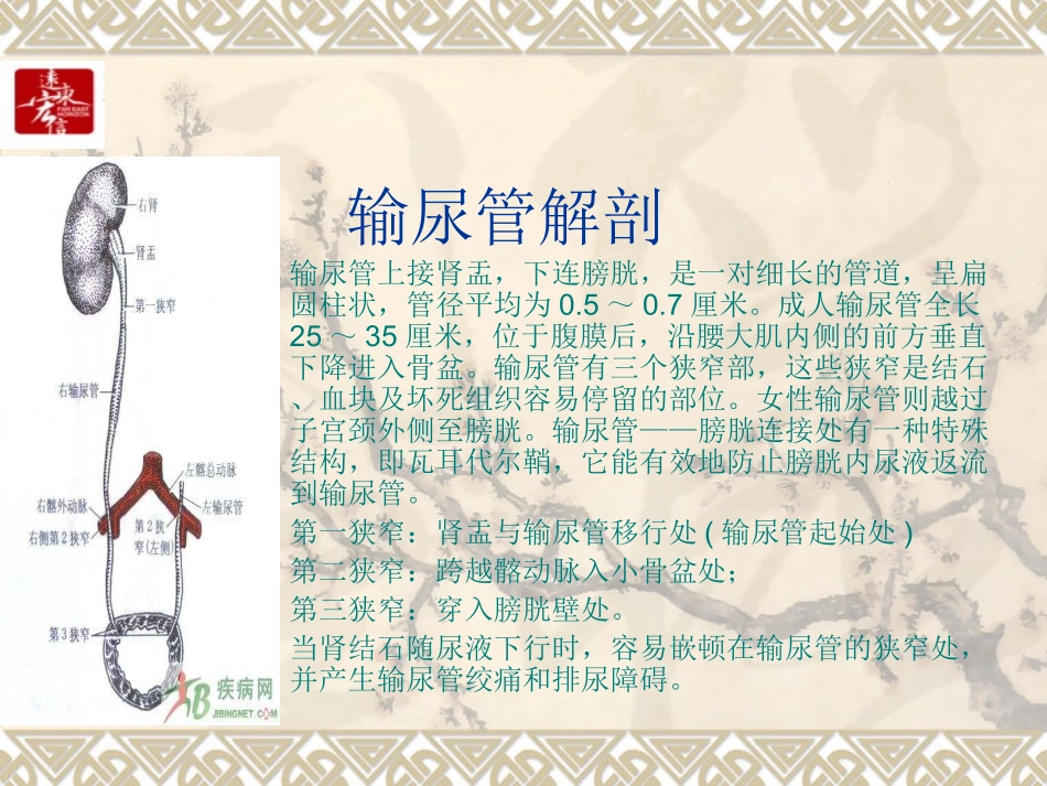 经尿道输尿管镜碎石取石术(严远平)_第3页