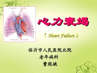 心力衰竭护理查房_ppt