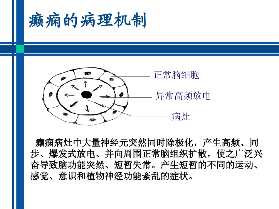 抗癫痫药物介绍_第3页