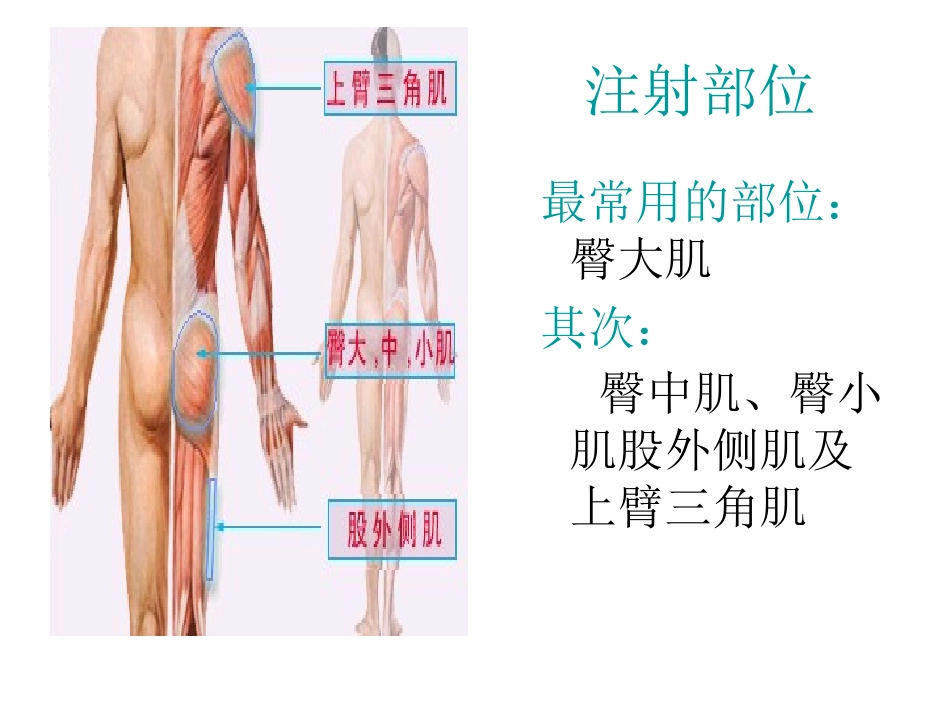 肌肉注射-PPT(精)_第3页