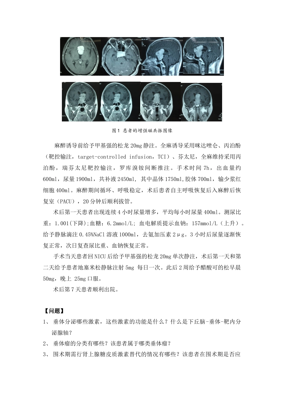 样版病例分析_第2页