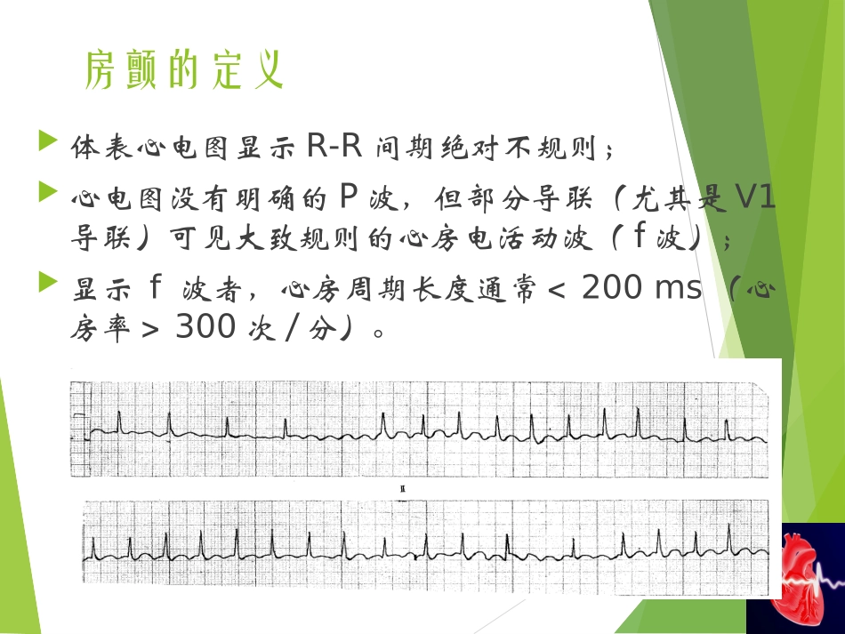 最新房颤治疗指南-闫伟_第2页