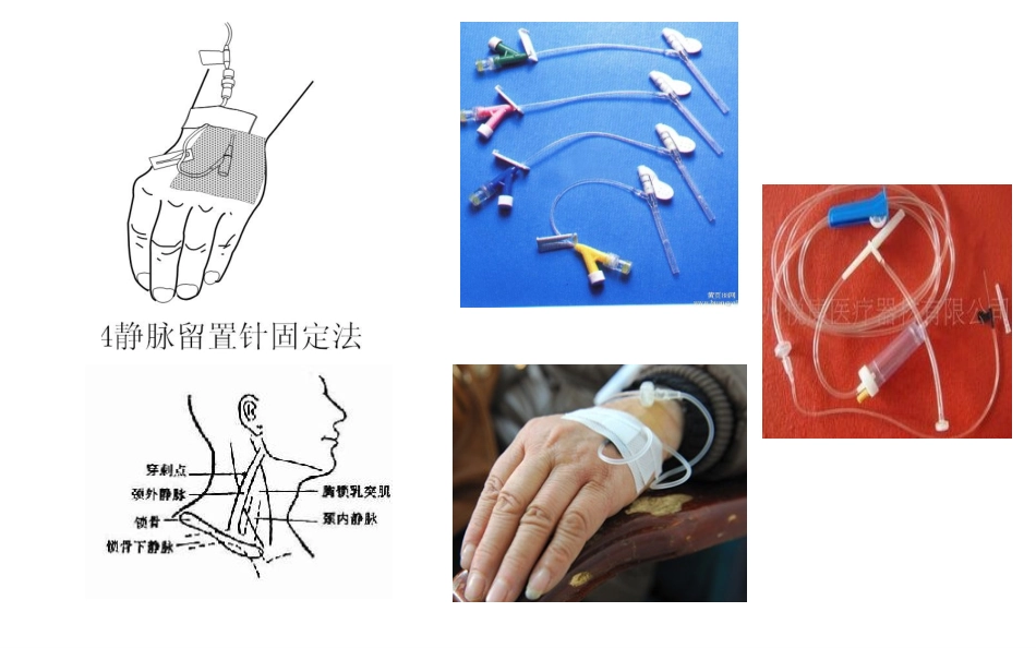 门诊输液观察与护理修改_第2页