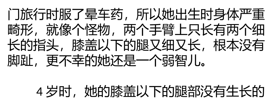 用膝盖行走的钢琴家_第2页