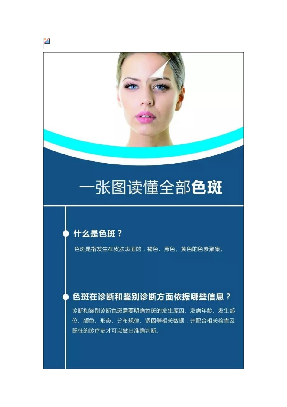 一张图教会你如何诊断和鉴别诊断常见色斑_第2页