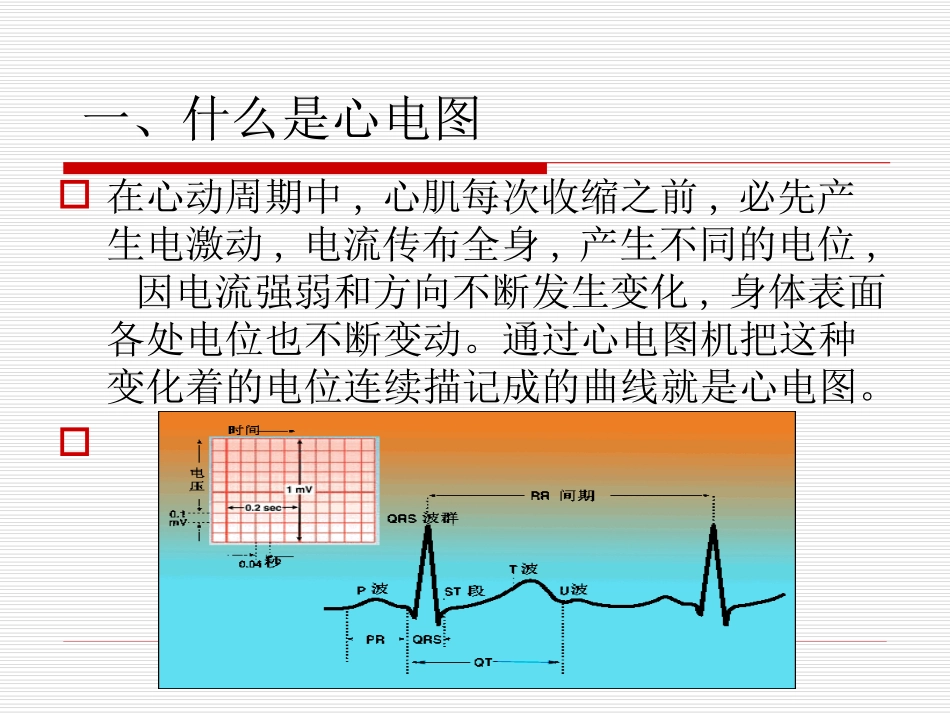 18导联心电图检查-PPT(精)_第2页