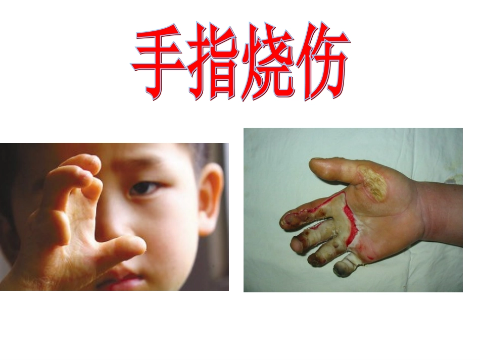 危险品小孩不能碰_第3页