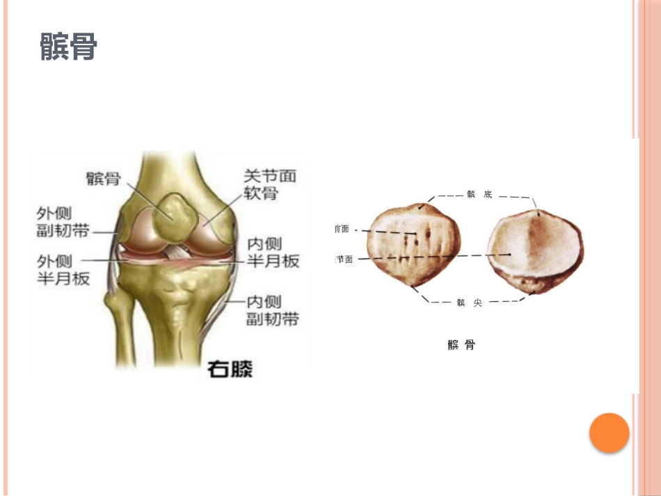 髌骨骨折护理查房_第2页