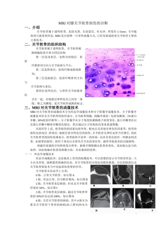 MRI对膝关节软骨损伤的诊断