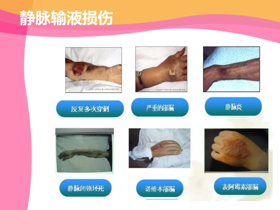 PICC的居家护理_第3页