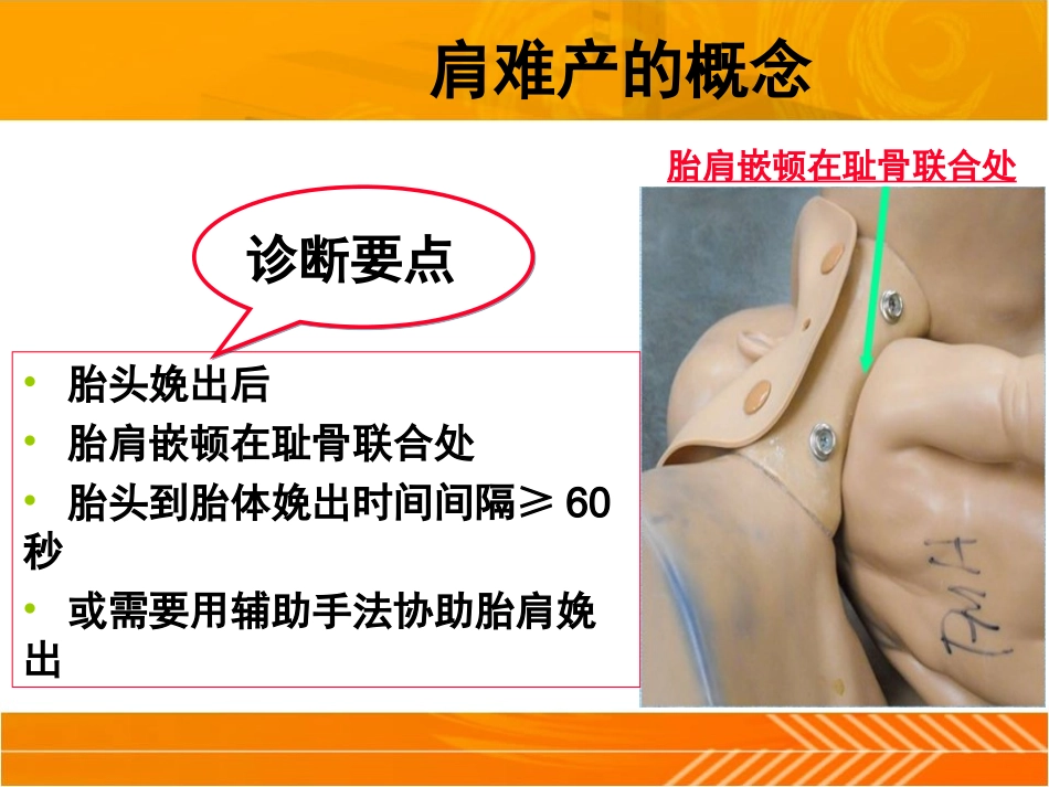 肩难产的处理 (1)_第3页