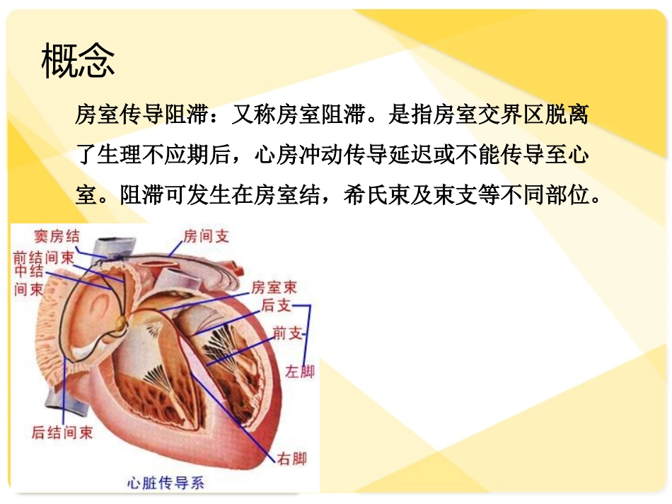三度房室传导阻滞护理查房_第3页
