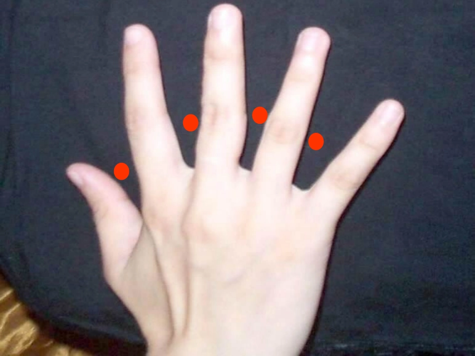 四年级数学植树问题PPT_第2页