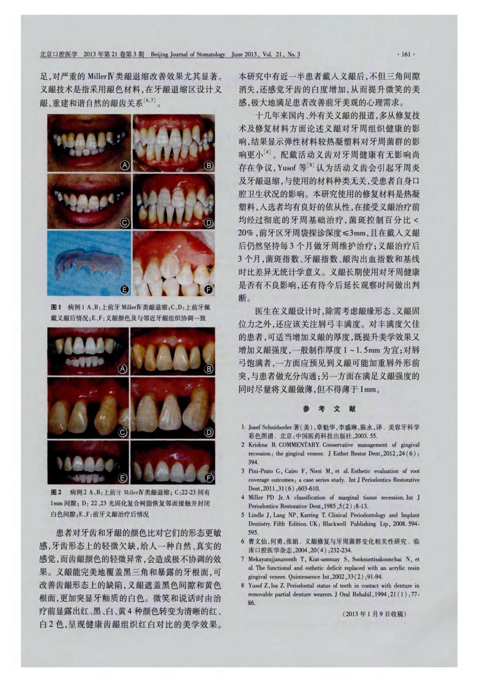 义龈在前牙牙龈退缩中的临床应用_第3页