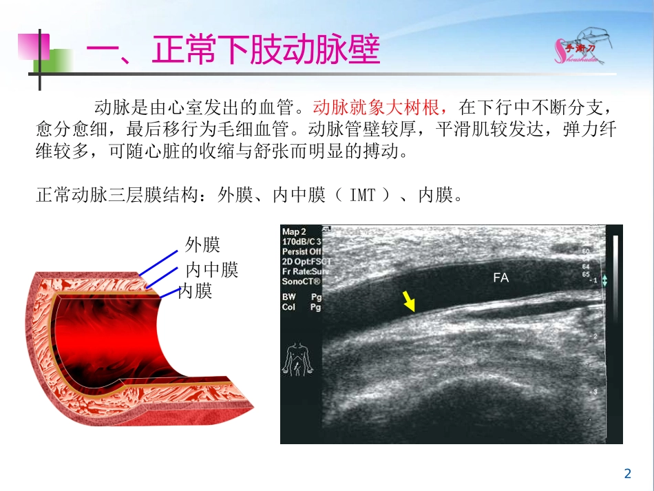 下肢血管的超声检查及正常声像图_第2页