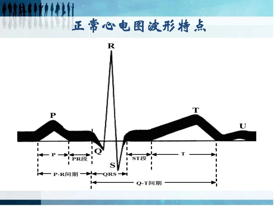 常见异常心电图的识别及处理_第3页