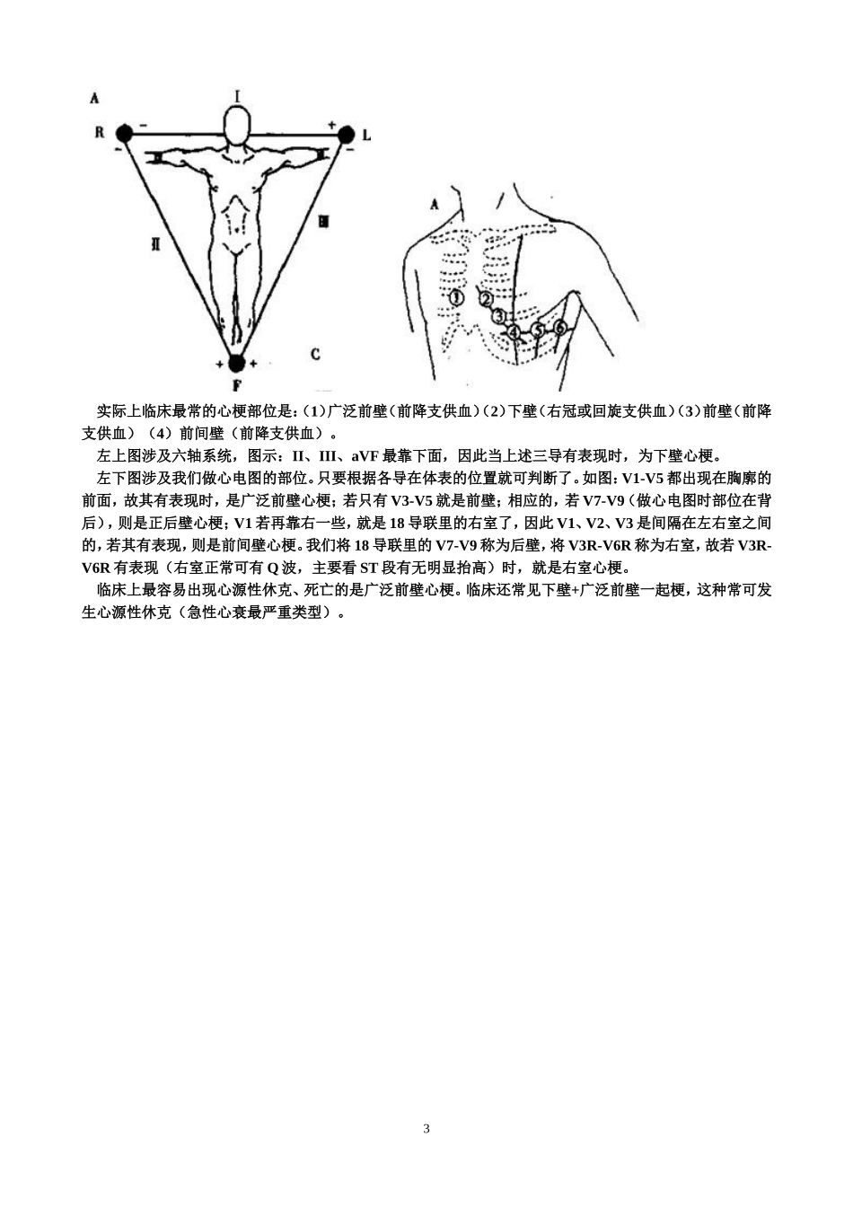 常见异常心电图及处理_第3页