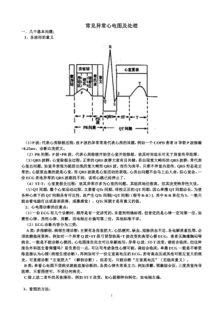 常见异常心电图及处理