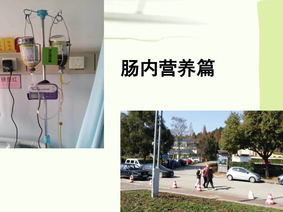 肠内肠外营养护理2017623233863_第3页