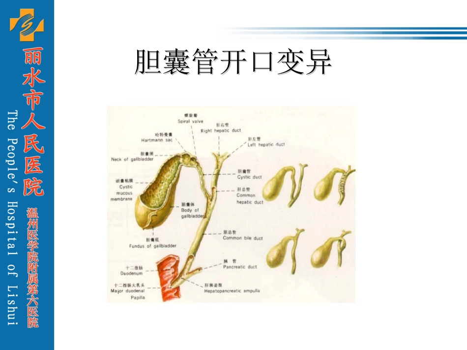 胆囊结石及其防治._第3页