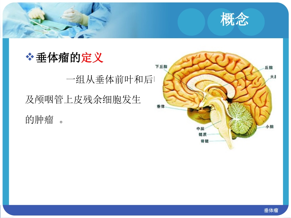 垂体瘤护理查房课件_第2页