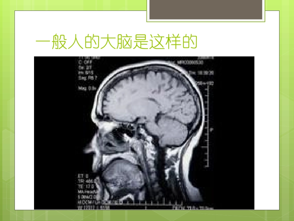 大脑的结构与功能_第3页