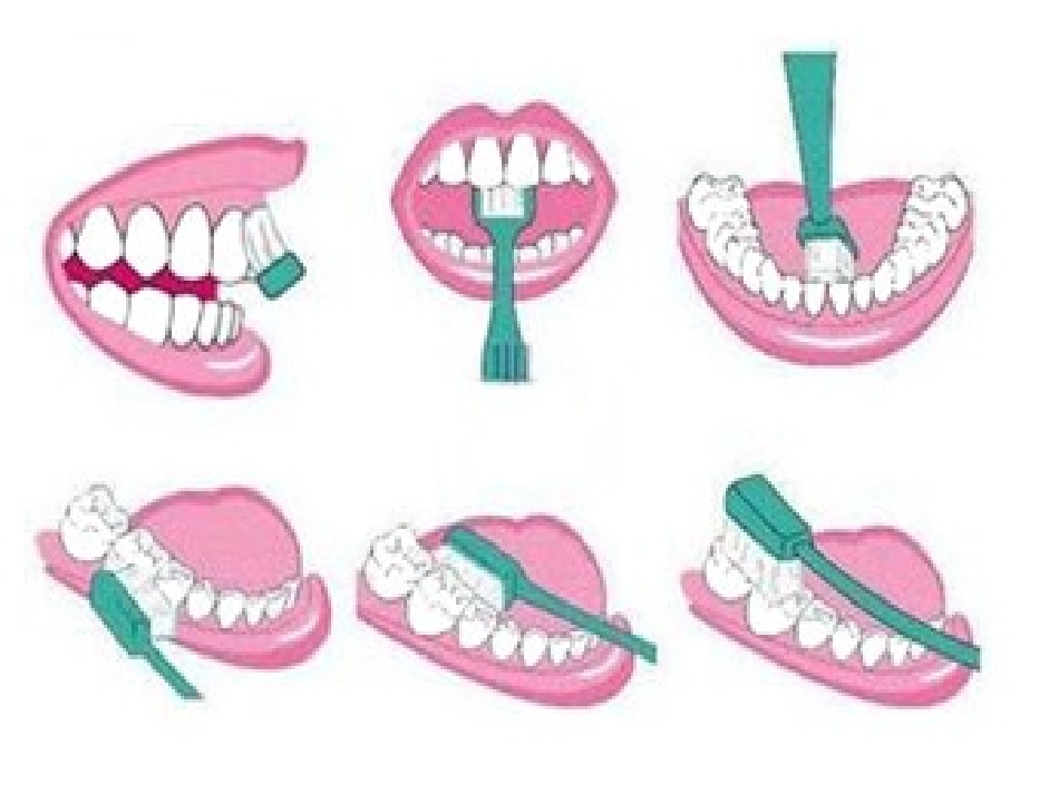 大班艺术活动音乐《刷牙歌》_第3页