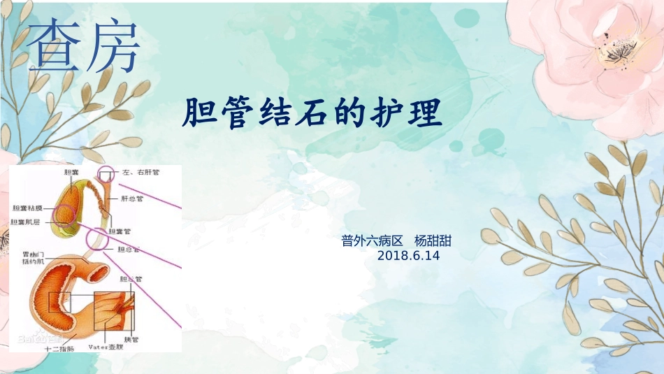 胆管结石护理查房_第1页