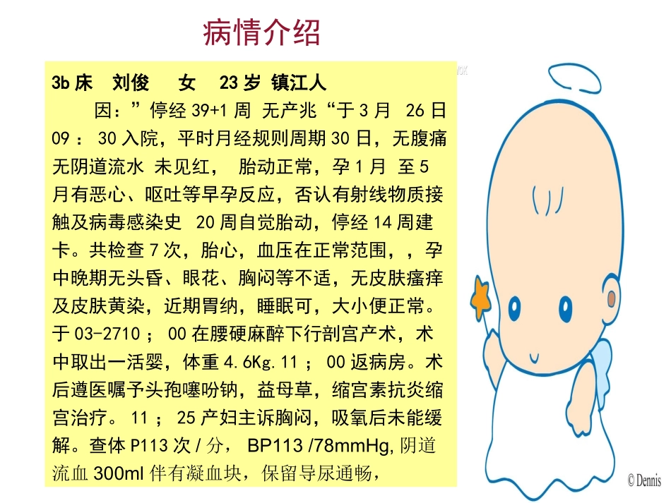 产后出血护理查房(新)_第2页