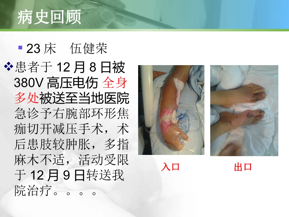 电击伤的护理查房_第2页