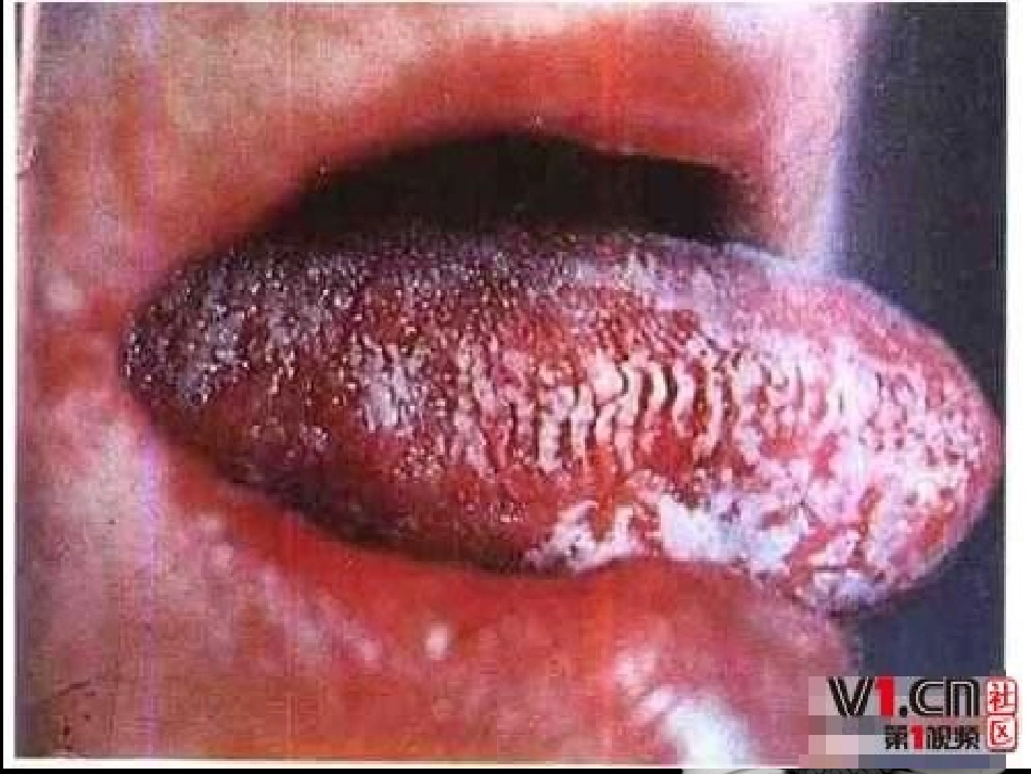 《艾滋病小斗士》_课件_第3页