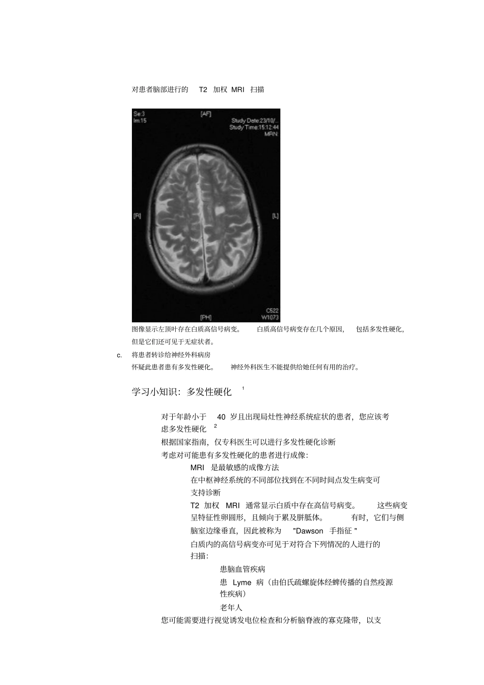 中风-鉴别诊断1讲座_第2页
