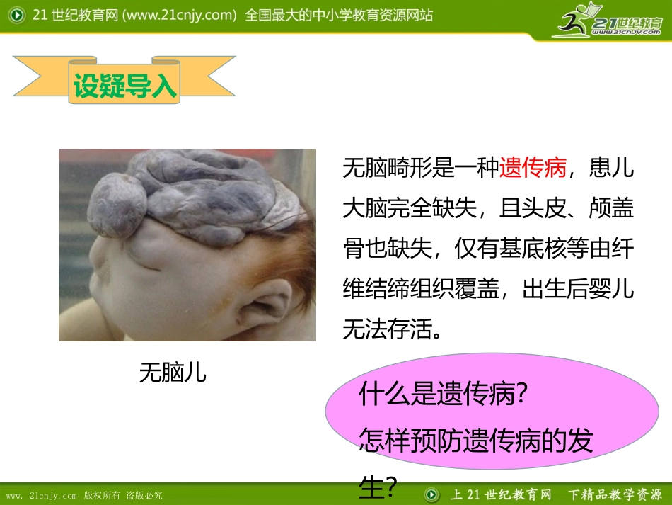 第三节遗传病与优生_第2页