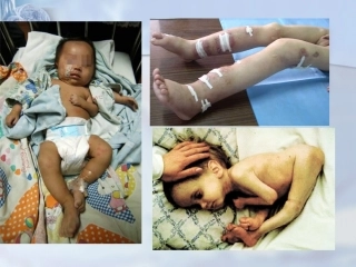 第1节选择健康的生活方式