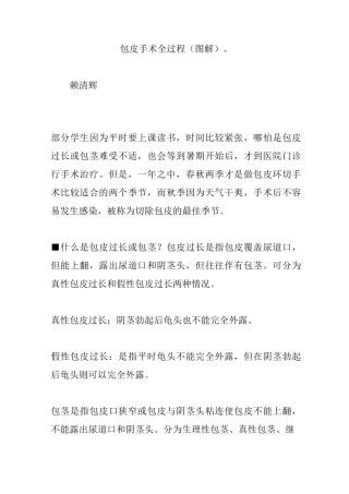 包皮手术全过程(图解)。