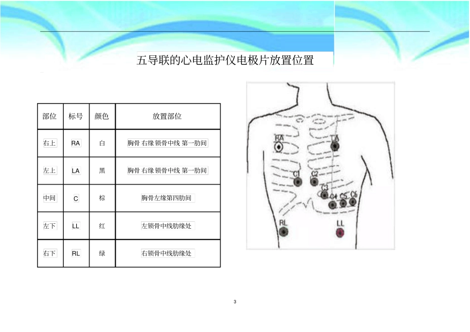 五导联的心电监护仪电极片放置位置剖析_第3页
